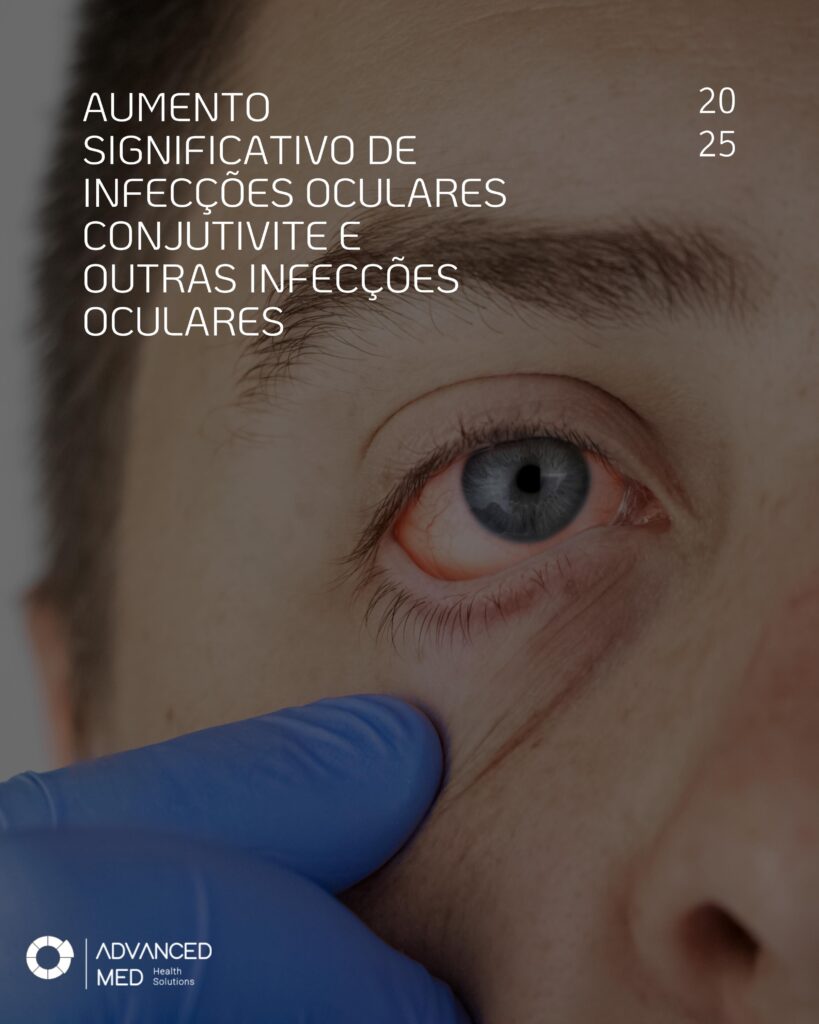 Atenção, esteticistas e lash designers: o aumento das infecções oculares, como conjuntivite, está diretamente ligado à falta de higienização adequada de instrumentos. Reduza riscos utilizando o Detergente Hospitalar SMART e o Pré-Limpeza SMART Advanced Med para limpeza profissional de pinças e acessórios de extensão de cílios. Biossegurança começa com protocolos corretos.