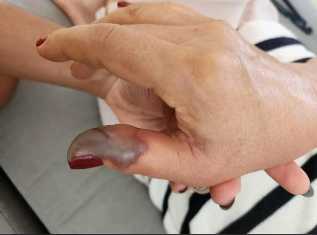 Instrumentos de manicure em processo de pré-limpeza com produto hospitalar Advanced Med, indicado para biossegurança em salões e clínicas de podologia.
