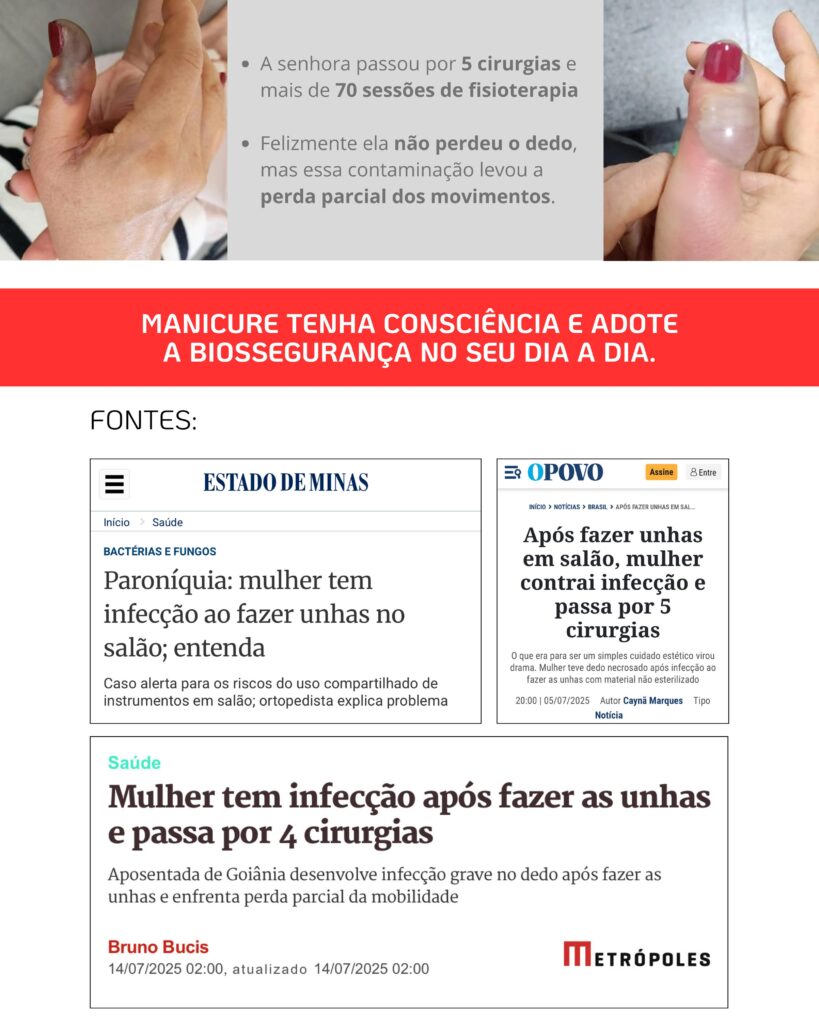 Detergente Hospitalar Smart Advanced Med ao lado de alicates de manicure e instrumentos de podologia prontos para esterilização.